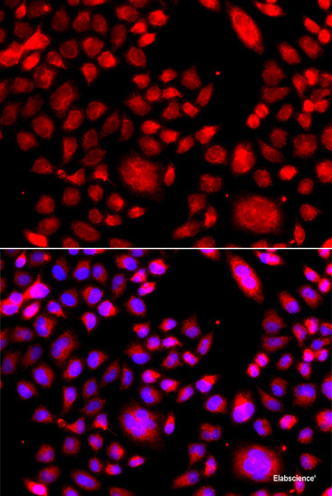 Immunohistochemistry of paraffin-embedded Human gastric using RAC1 Polyclonal Antibody at dilution of  1:100 (40x lens).