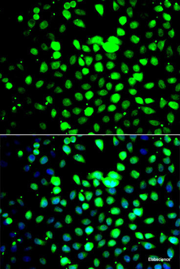 Western blot analysis of extracts of various cell lines using CLIP1 Polyclonal Antibody at dilution of 1:1000.