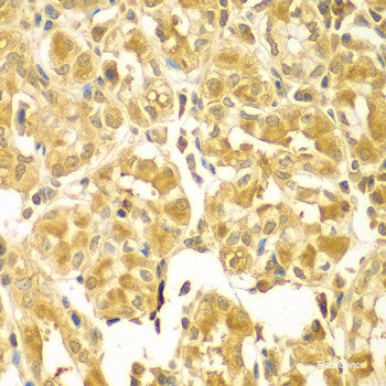 Immunohistochemistry of paraffin-embedded Mouse brain using STRN Polyclonal Antibody at dilution of  1:100 (40x lens).
