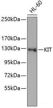 Western blot analysis of extracts of various cell lines using TNNC2 Polyclonal Antibody at dilution of 1:1000.
