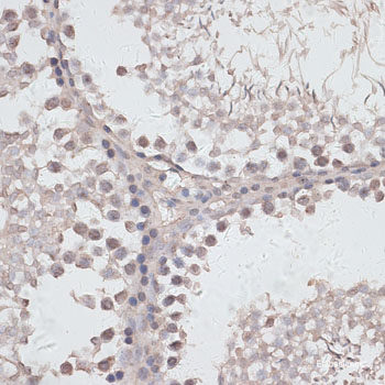 Immunohistochemistry of paraffin-embedded Mouse brain using TRPC3 Polyclonal Antibody