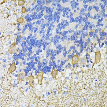 Immunofluorescence analysis of U2OS cells using PIP5K1B Polyclonal Antibody at dilution of  1:100. Blue: DAPI for nuclear staining.