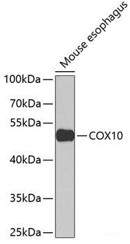 Immunohistochemistry of paraffin-embedded Human gastric using DGKE Polyclonal Antibody at dilution of  1:100 (40x lens).