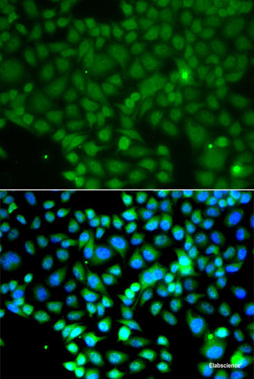 Immunohistochemistry of paraffin-embedded Mouse brain using NAT8 Polyclonal Antibody