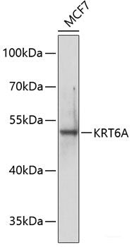Immunofluorescence analysis of A549 cells using MTMR4 Polyclonal Antibody
