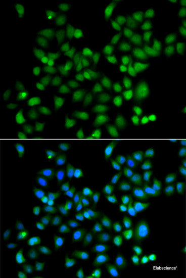 Immunohistochemistry of paraffin-embedded Mouse lung using COQ7 Polyclonal Antibody at dilution of  1:100 (40x lens).