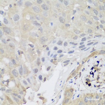 Immunofluorescence analysis of U2OS cells using ICK Polyclonal Antibody at dilution of  1:100. Blue: DAPI for nuclear staining.
