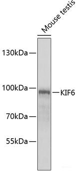 Immunofluorescence analysis of U2OS cells using RASGRP3 Polyclonal Antibody at dilution of  1:100. Blue: DAPI for nuclear staining.