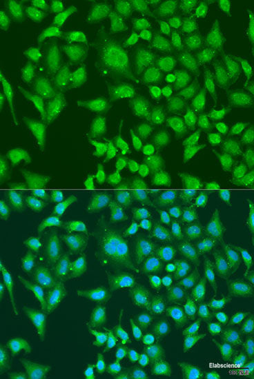 Western blot analysis of extracts of various cell lines using DKK4 Polyclonal Antibody at dilution of 1:1000.