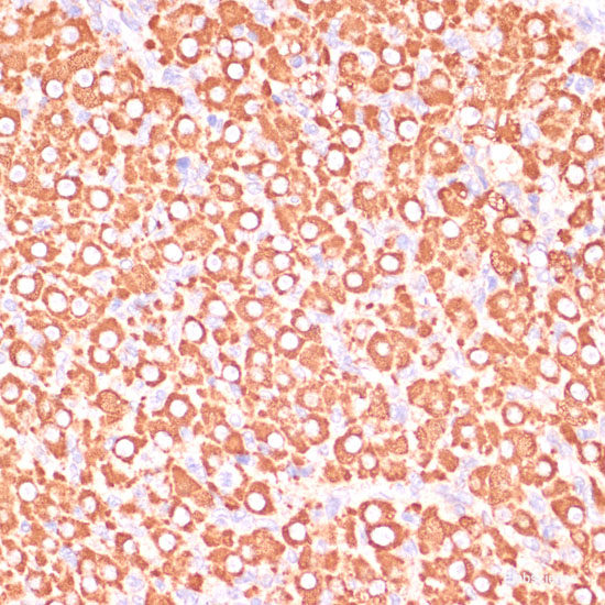 Western blot analysis of extracts of various cell lines using EYA3 Polyclonal Antibody at dilution of 1:1000.