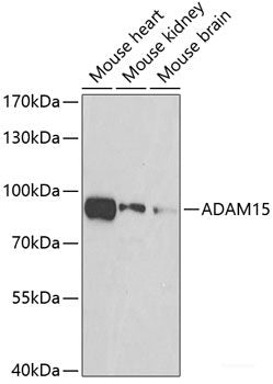Western blot analysis of extracts of various cell lines using SSX4 Polyclonal Antibody at dilution of 1:1000.