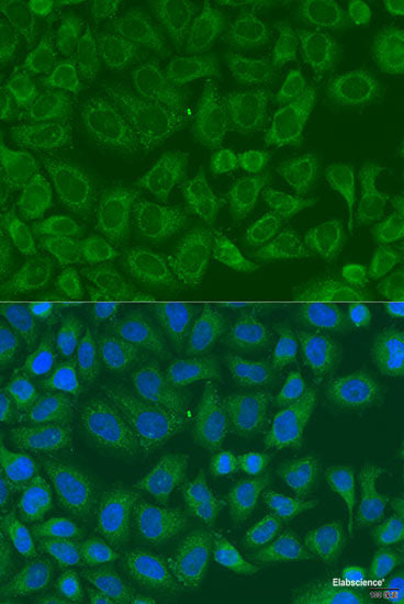 Western blot analysis of extracts of Mouse brain using ARHGEF11 Polyclonal Antibody at dilution of 1:1000.