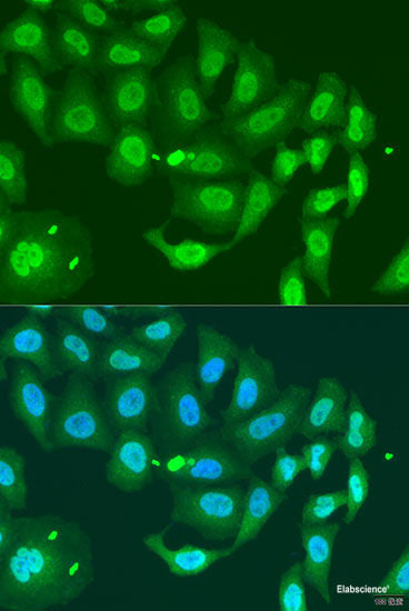 Western blot analysis of extracts of various cell lines using USP25 Polyclonal Antibody at dilution of 1:1000.