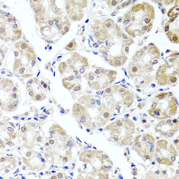 Immunofluorescence analysis of A549 cells using TDP1 Polyclonal Antibody