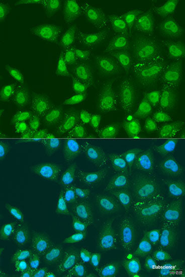 Immunofluorescence analysis of U2OS cells using BLOC1S2 Polyclonal Antibody at dilution of  1:100. Blue: DAPI for nuclear staining.