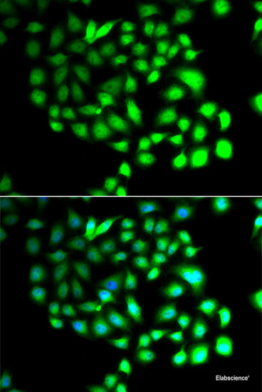 Immunofluorescence analysis of A549 cells using MLF1 Polyclonal Antibody