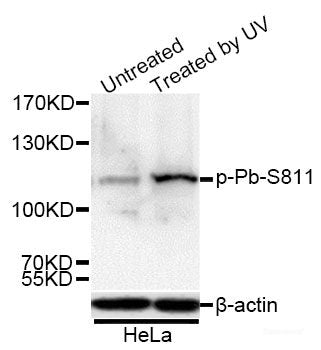 Immunohistochemistry of paraffin-embedded Rat heart using Phospho-GJA1(S368) Polyclonal Antibody at dilution of  1:200 (40x lens).