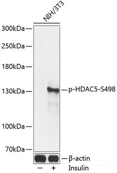 Western Blot analysis of various samples using SNCA Polyclonal Antibody at dilution of 1:600.