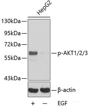 Western Blot analysis of various samples using EPO Polyclonal Antibodyat dilution of 1:1000.
