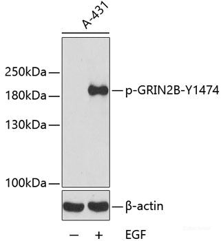 Immunohistochemistry analysis of paraffin-embedded human liver  using MPO Polyclonal Antibody at dilution of 1:300.