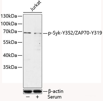 Immunohistochemistry analysis of paraffin-embedded Human tonsil  using NLRP3 Polyclonal Antibody at dilution of 1:400.