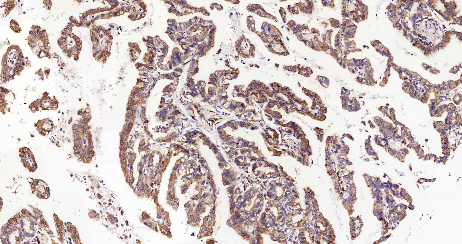 Immunohistochemistry analysis of paraffin-embedded mouse inflammation spleen  using INPP5D Polyclonal Antibody at dilution of 1:300.