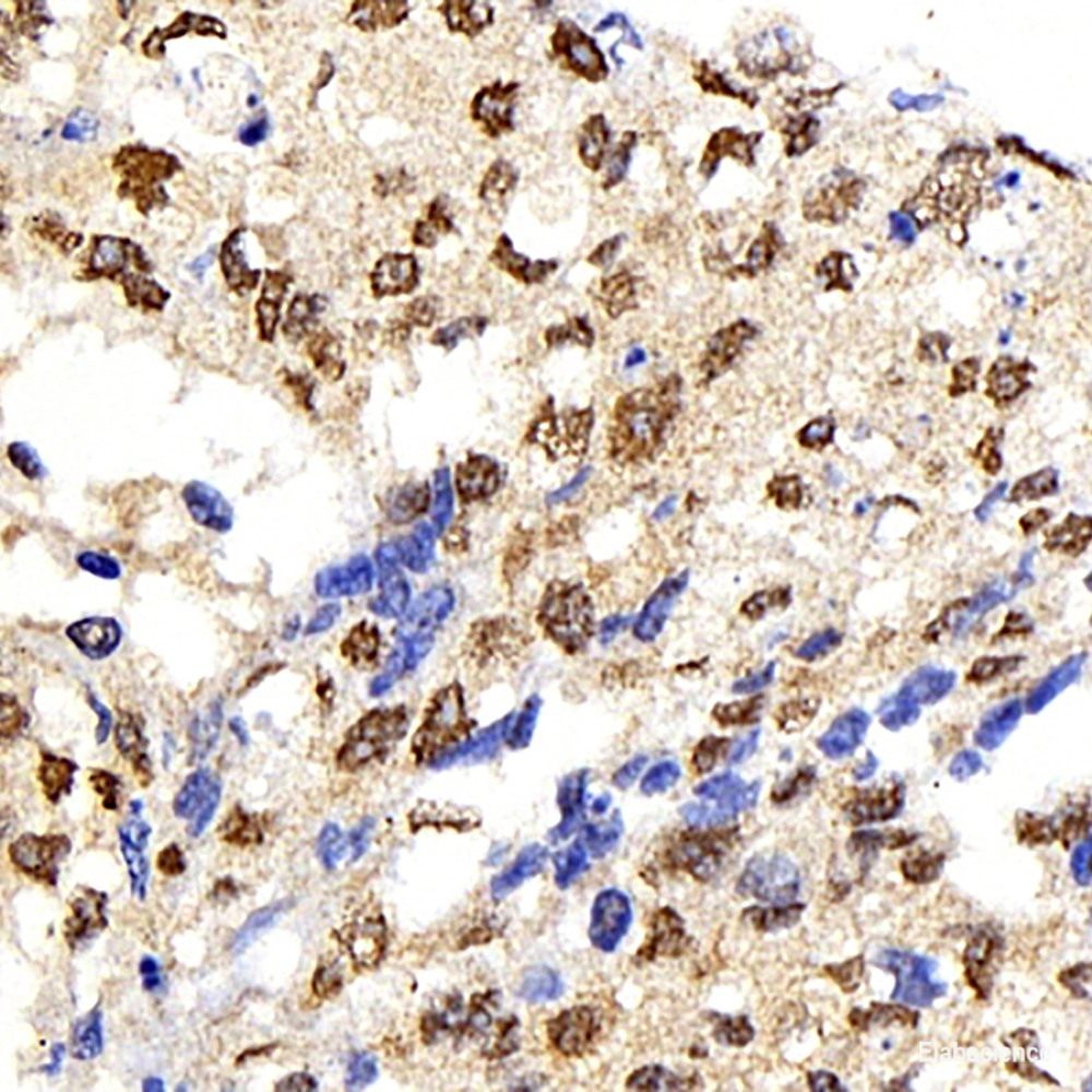 Immunohistochemistry analysis of paraffin-embedded mouse kidney  using ROCK1 Polyclonal Antibody at dilution of 1:300.