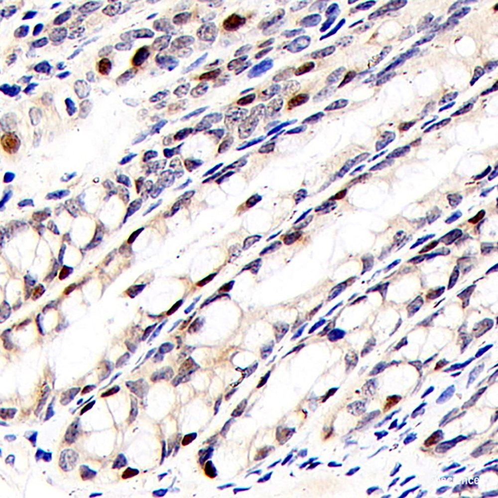 Immunohistochemistry analysis of paraffin-embedded Human hysteromyoma  using VWF Polyclonal Antibody at dilution of 1:300.