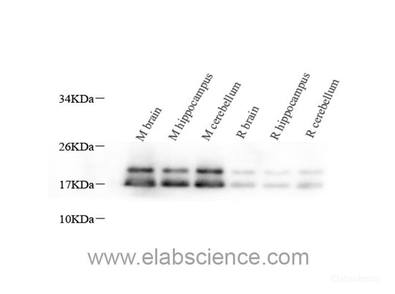 Immunohistochemistry analysis of paraffin-embedded mouse lung  using CD68 Polyclonal Antibody at dilution of 1:300.