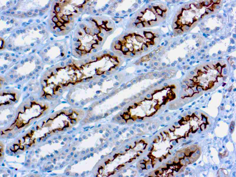 Ezrin/p181/Cytovillin