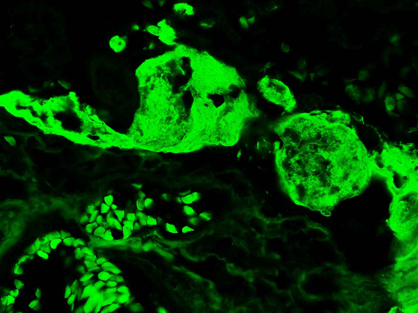 Fibrinogen-FITC