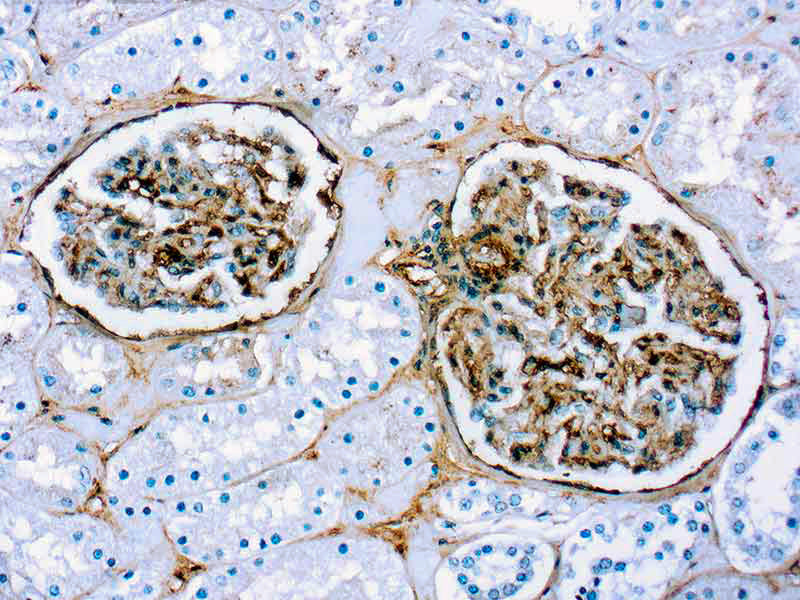 Fibronectin