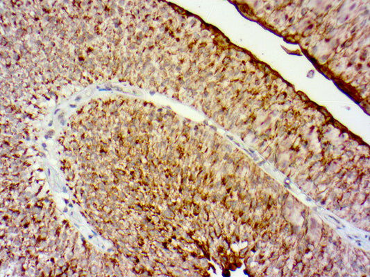 Uroplakin 11 (UPK2)