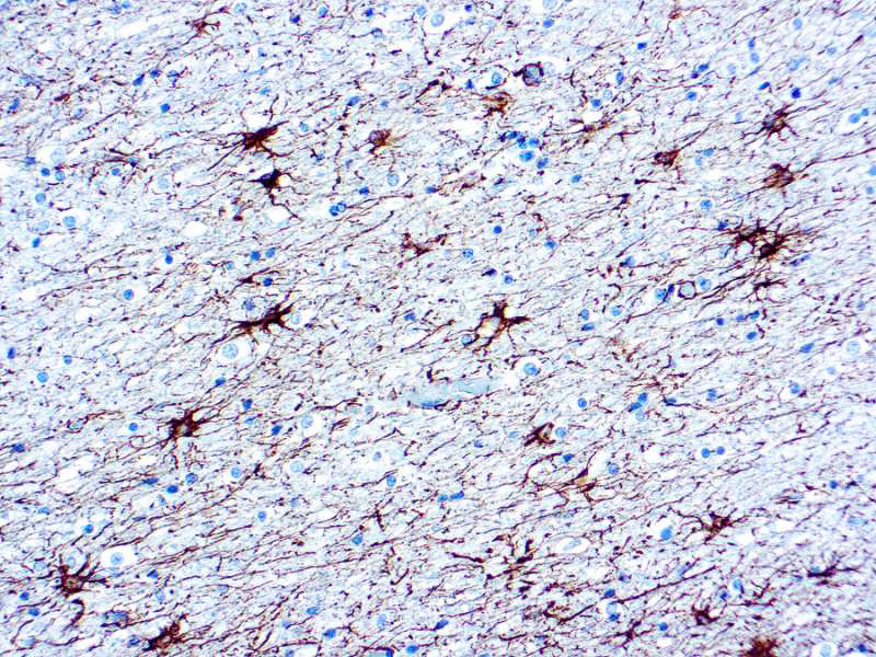 Glial Fibrillary Acidic Protein (GFAP)
