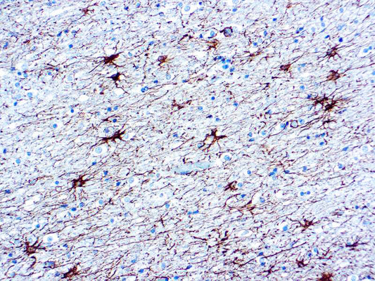 Glial Fibrillary Acidic Protein (GFAP)