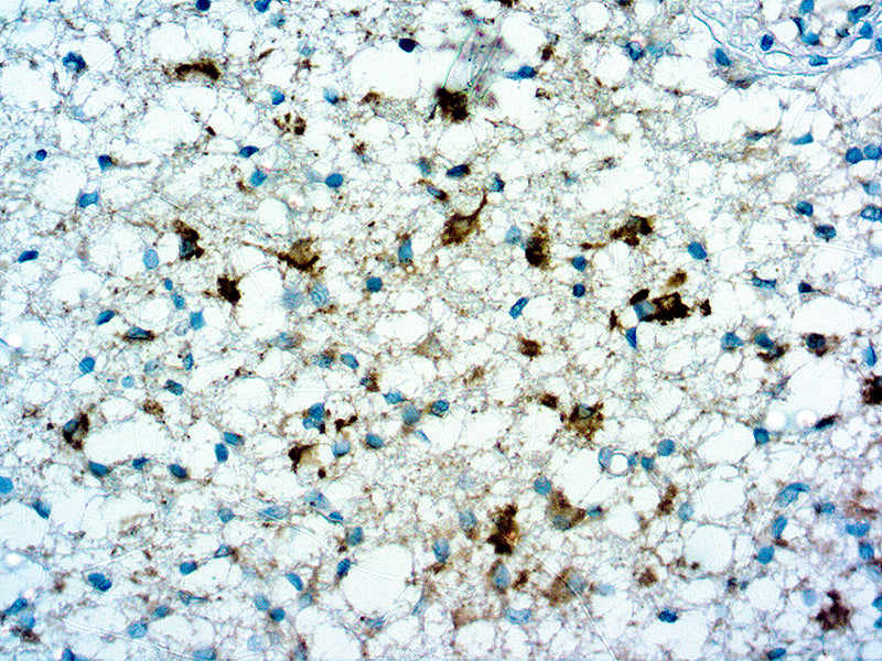 Anti-Isocitrate Dehydrogenenase 1 (IDH1)-R132H