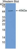 Monoclonal Antibody to Activated Leukocyte Cell Adhesion Molecule (ALCAM)