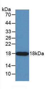 Monoclonal Antibody to Angiogenin (ANG)