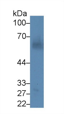 Monoclonal Antibody to Angiopoietin 1 (ANGPT1)
