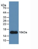 Monoclonal Antibody to Connective Tissue Growth Factor (CTGF)