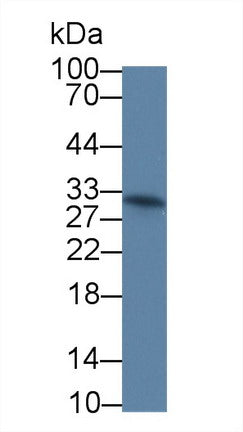 Monoclonal Antibody to Interleukin 12A (IL12A)