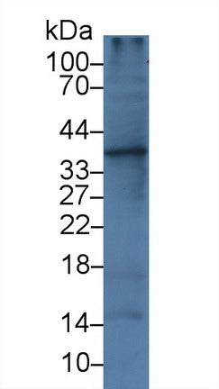 Monoclonal Antibody to Interleukin 1 Alpha (IL1a)