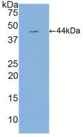 Monoclonal Antibody to Interleukin 6 (IL6)