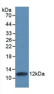 Monoclonal Antibody to Interleukin 8 (IL8)