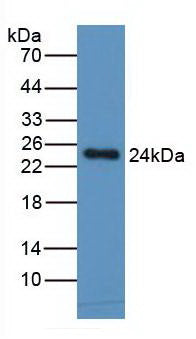 Monoclonal Antibody to Monocyte Chemotactic Protein 1 (MCP1)