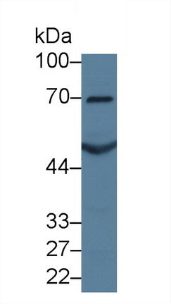 Monoclonal Antibody to Transforming Growth Factor Beta 1 (TGFb1)