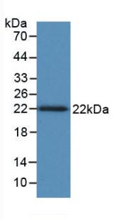 Monoclonal Antibody to Tumor Necrosis Factor Beta (TNFb)