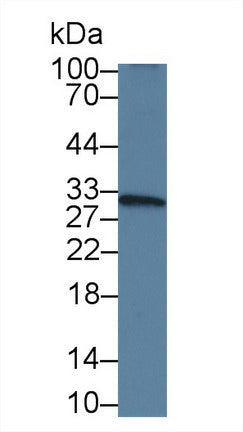Monoclonal Antibody to Vascular Endothelial Growth Factor A (VEGFA)