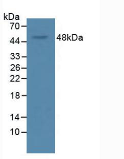 Monoclonal Antibody to Vascular Endothelial Growth Factor A (VEGFA)