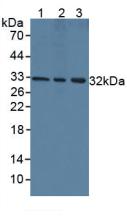 Monoclonal Antibody to Vascular Endothelial Growth Factor A (VEGFA)